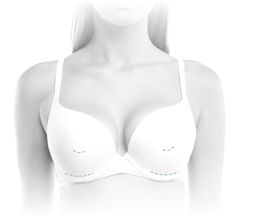 Breast Augmentation Las Vegas Breast Implants Henderson NV