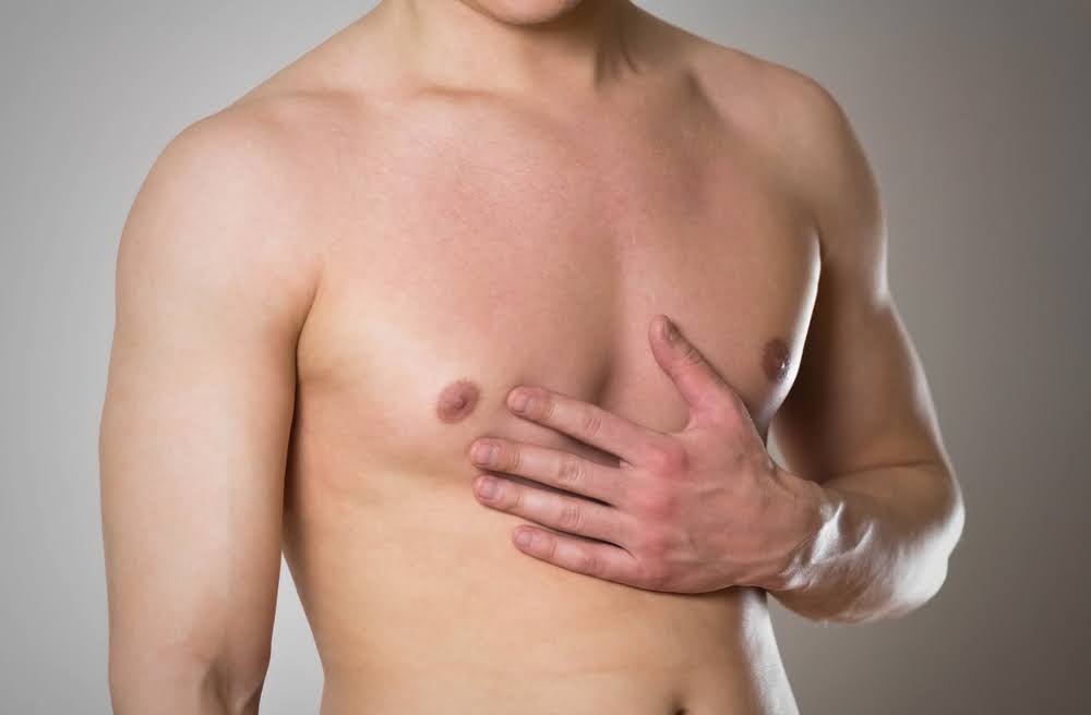 Shirtless man after gynecomastia surgery