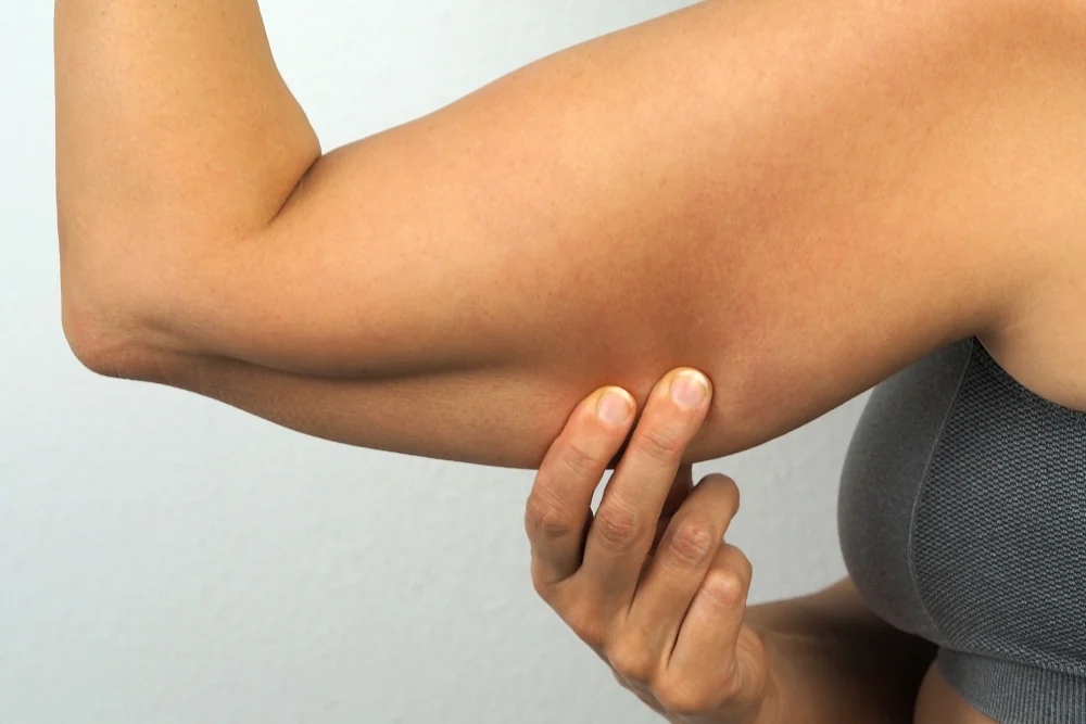 Woman pinching her tricep skin after weight loss